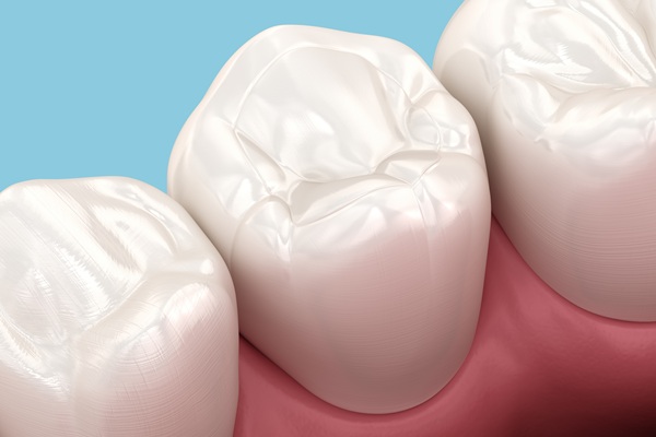 What To Avoid After Getting A New Dental Filling